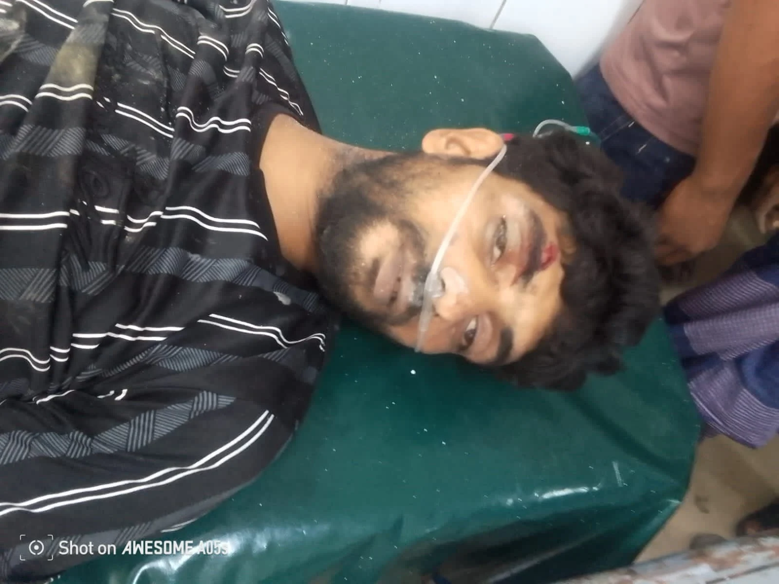 ফেনীতে ফোনে কথা বলতে বলতে ছাদ থেকে পড়ে শ্রমিকের মৃত্যু