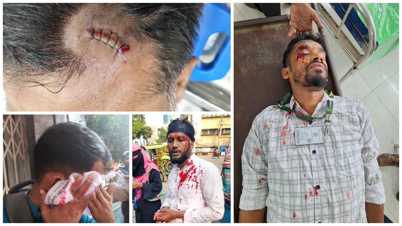মতিঝিলে আন্দোলনরত ইসলামী ব্যাংকের চাকরিচ্যুতদের ওপর হামলা